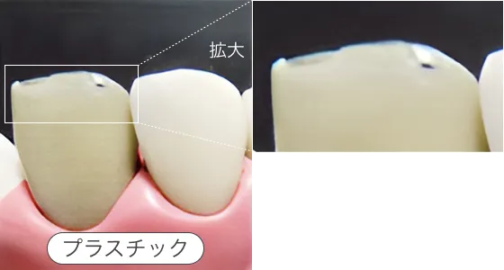 セラミックとプラスチックの違い