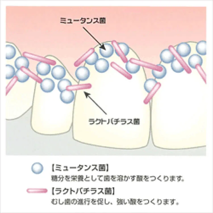 ミュータンス菌とラクトパチラス菌